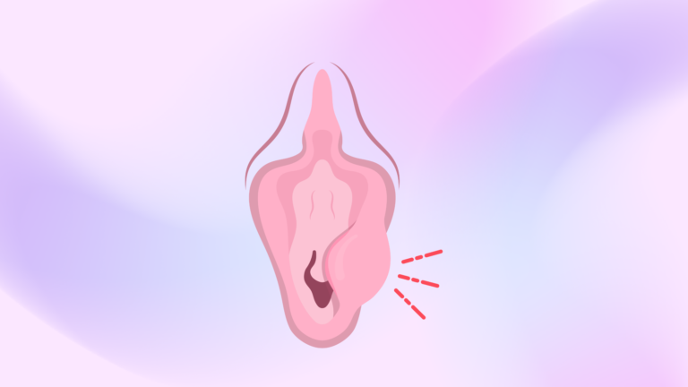 Diferença entre Cisto de Bartholin e Bartholinite